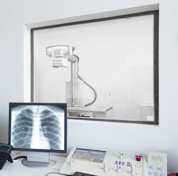 Radiographie de la colonne vertébrale - la principale méthode de diagnostic de l'ostéochondrose