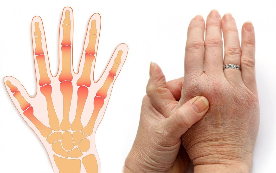 maladies des doigts