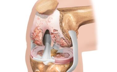 Schéma des ligaments