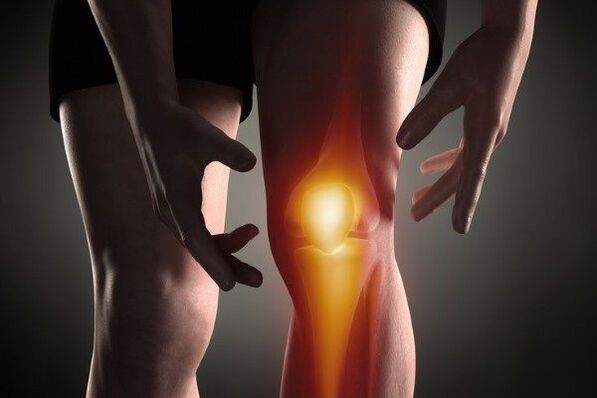 Arthrose de l'articulation du genou