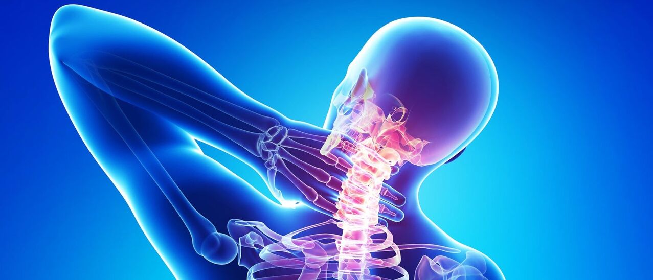 L'ostéochondose cervicale est un processus pathologique dans la zone de la colonne vertébrale