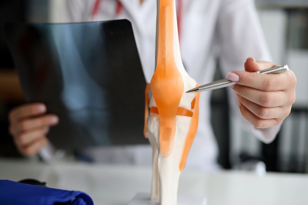 Démonstration d'une articulation dans laquelle des changements dégénératifs conduisent au développement de l'arthrose